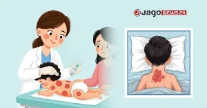 ham-disease-06-mth3bf9rurdxf9p-20260831162514.jpg